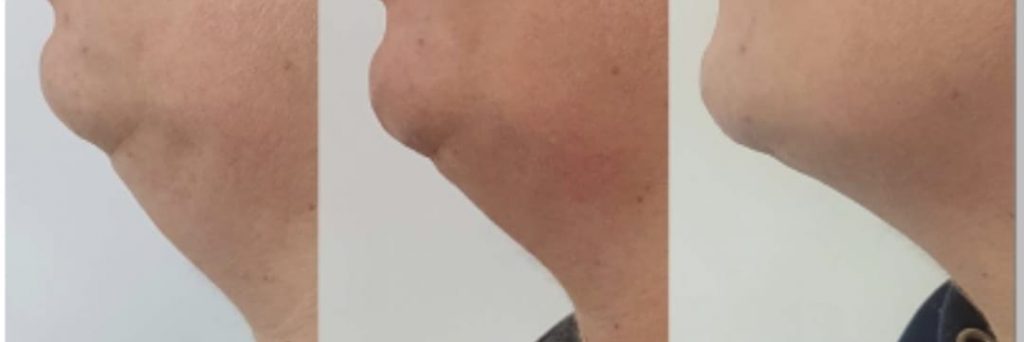 WhatsApp Image 2025-02-25 at 14.40.22_ec5d2673