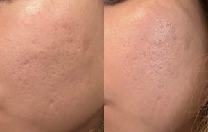 WhatsApp Image 2025-02-25 at 15.03.31_087b001e